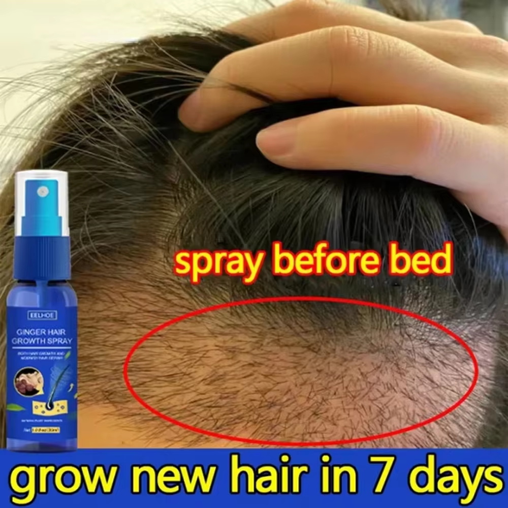 Hair Care Basic - Fast Ginger Hair Growth Spray Roots