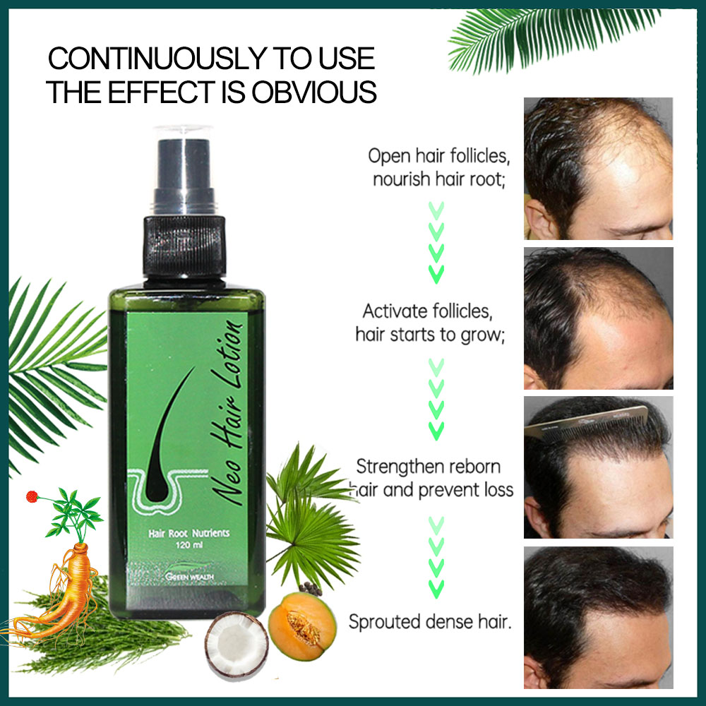 4 pcs Neo Hair Lotion 120ml Ha - огляд і ціна Hair Care Basic
